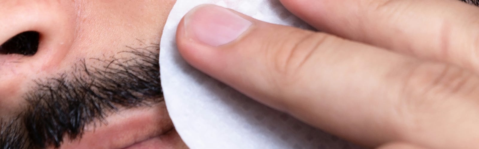 Patient tr&auml;gt Cannabis-Creme bei Psoriasis auf die Haut auf